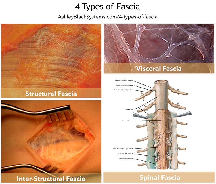 Cuatro tipos de fascias