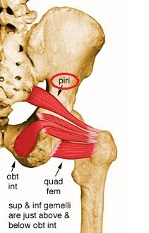 Pelvis piramidal