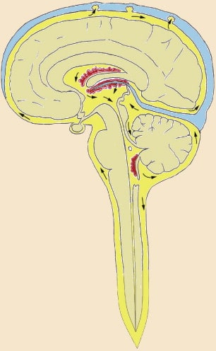 Plexos coroideos