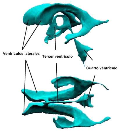 Ventrículos cerebrales